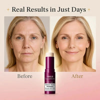 Velmira Skin Renewal Balm – Firming + Hydration in One